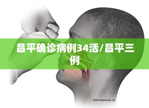 昌平确诊病例34活/昌平三例