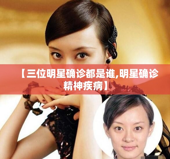 【三位明星确诊都是谁,明星确诊精神疾病】 【三位明星确诊都是谁,明星确诊精神疾病】