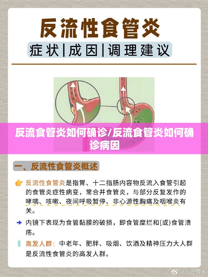 反流食管炎如何确诊/反流食管炎如何确诊病因 反流食管炎如何确诊/反流食管炎如何确诊病因