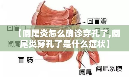 【阑尾炎怎么确诊穿孔了,阑尾炎穿孔了是什么症状】 【阑尾炎怎么确诊穿孔了,阑尾炎穿孔了是什么症状】
