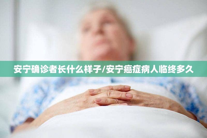 安宁确诊者长什么样子/安宁癌症病人临终多久 安宁确诊者长什么样子/安宁癌症病人临终多久